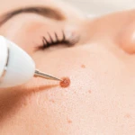 Clínica Cherubim | Dermatologista Infantil, Estética, Cirúrgica e Clínica na Mooca - SP