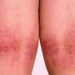 Clínica Cherubim | Dermatologista Infantil, Estética, Cirúrgica e Clínica na Mooca - SP