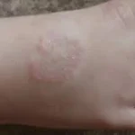 Clínica Cherubim | Dermatologista Infantil, Estética, Cirúrgica e Clínica na Mooca - SP