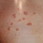 Clínica Cherubim | Dermatologista Infantil, Estética, Cirúrgica e Clínica na Mooca - SP