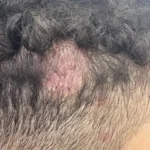 Clínica Cherubim | Dermatologista Infantil, Estética, Cirúrgica e Clínica na Mooca - SP