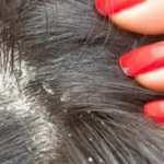 Clínica Cherubim | Dermatologista Infantil, Estética, Cirúrgica e Clínica na Mooca - SP