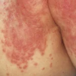 Clínica Cherubim | Dermatologista Infantil, Estética, Cirúrgica e Clínica na Mooca - SP